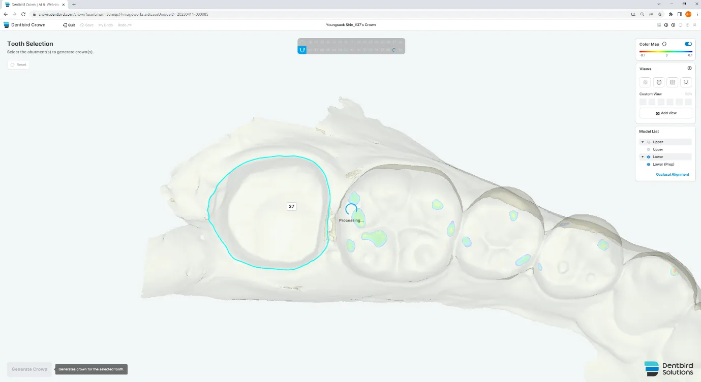 Dentbird: AI Dental CAD Software