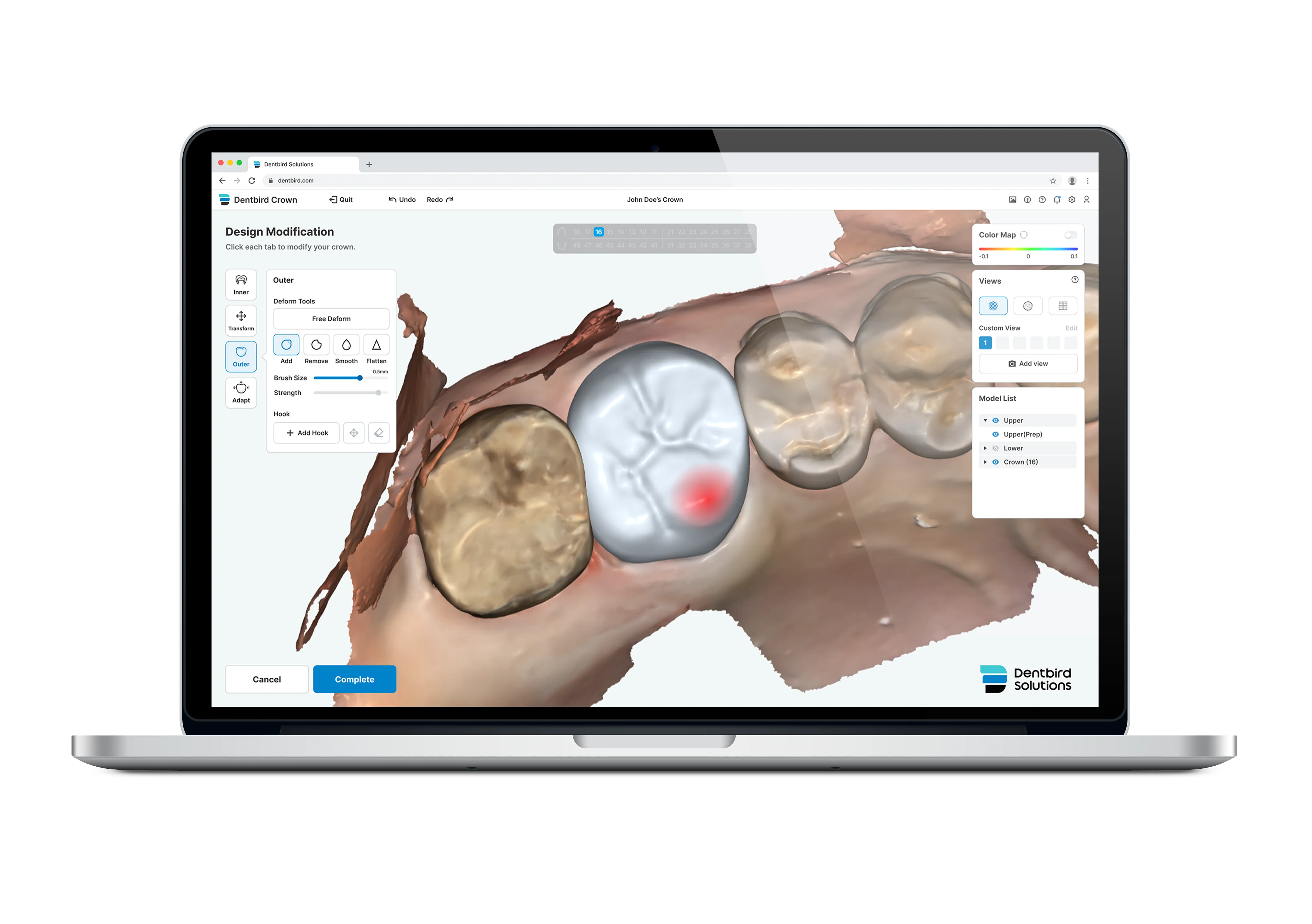 Dentbird: AI Dental CAD Software