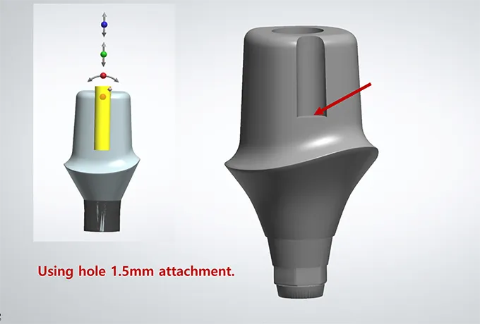 Dentbird: Dental CAD for Digital Dentistry on the Web