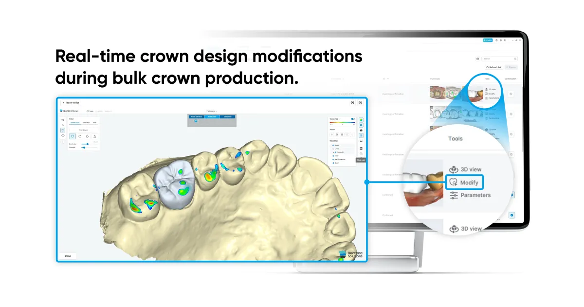 Dentbird: AI Dental CAD Software