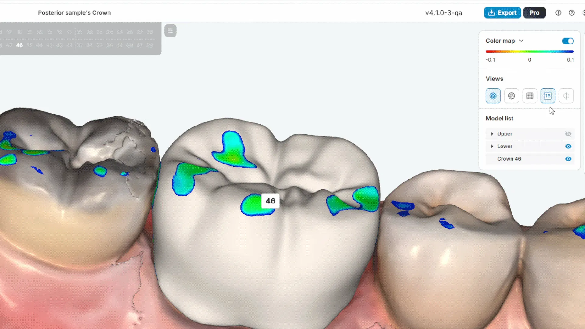 Dentbird: AI Dental CAD Software