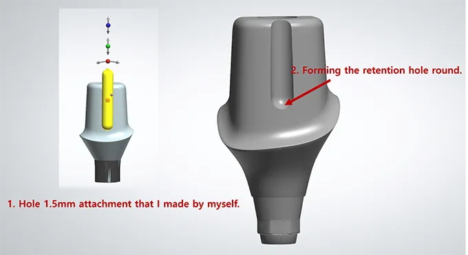 Dentbird: Dental CAD for Digital Dentistry on the Web