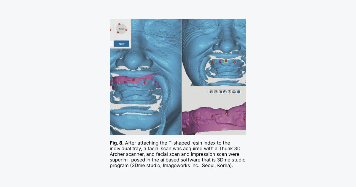 Dentbird: Dental CAD for Digital Dentistry on the Web