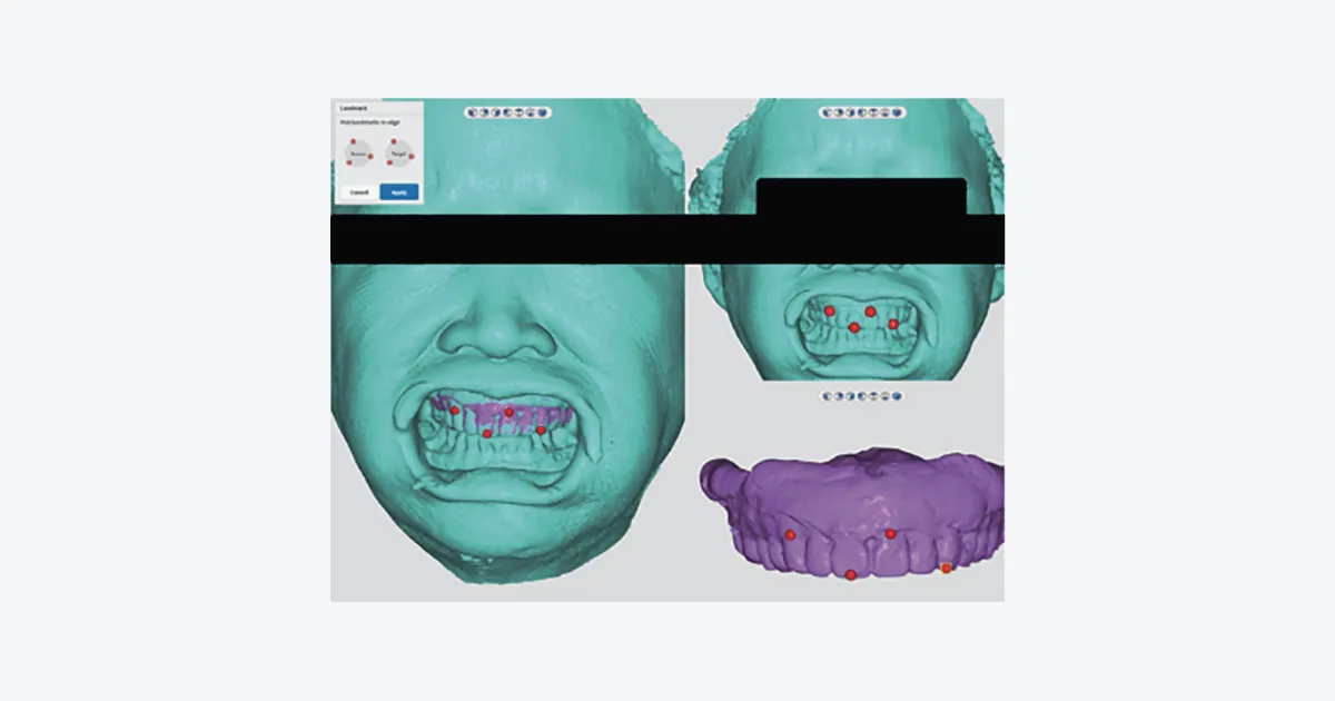 Dentbird: Dental CAD for Digital Dentistry on the Web