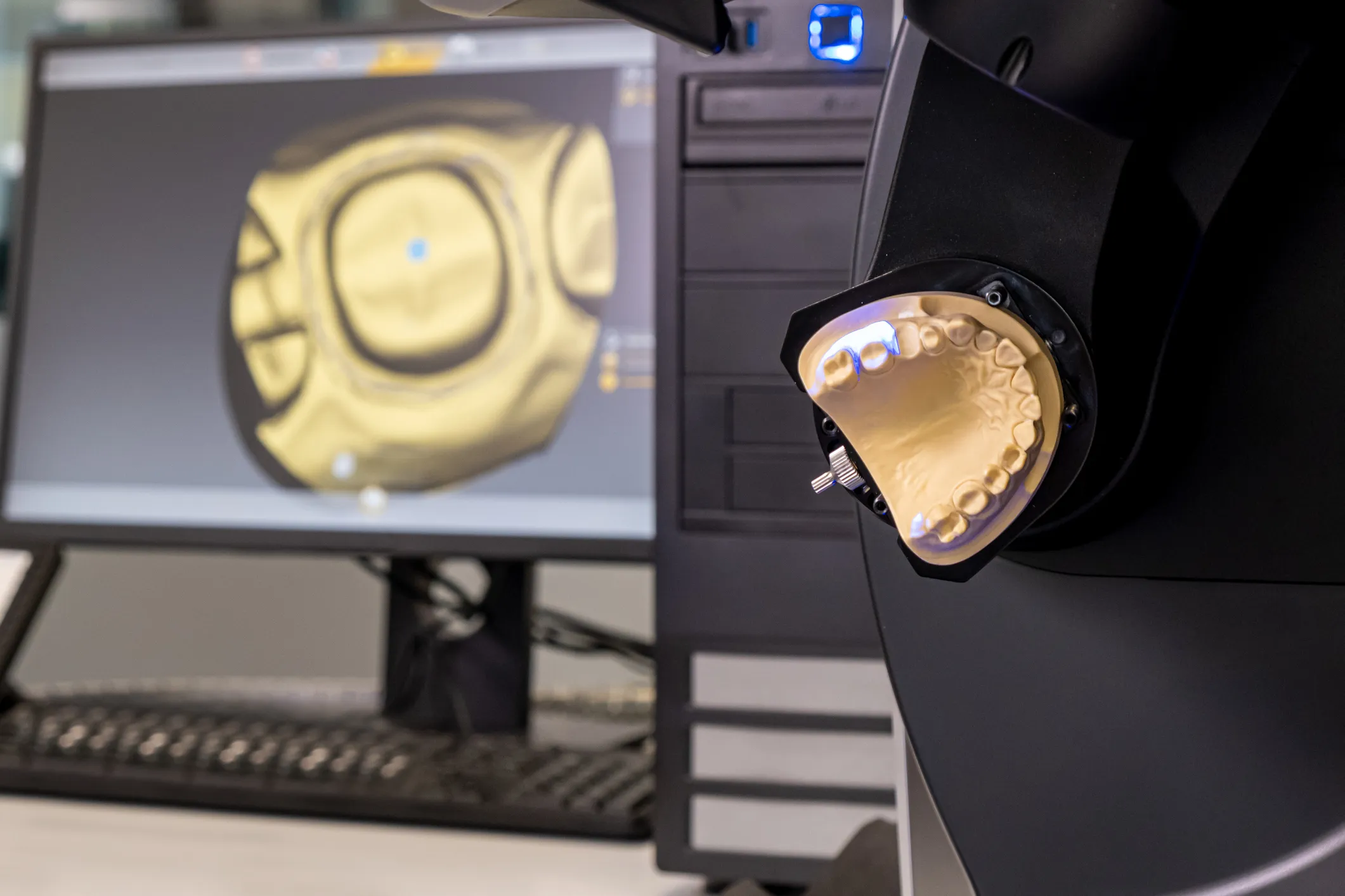 Dentbird: Dental CAD for Digital Dentistry on the Web